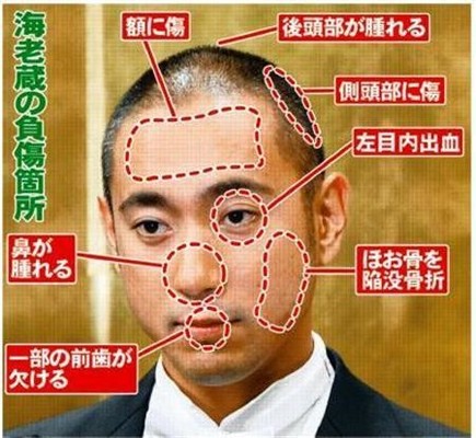 【海老蔵暴行事件の詳細】「灰皿テキーラ」や関東連合との黒い噂のイメージ